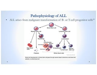 Pathophysiology of ALL
• ALL arises from malignant transformation of B- or T-cell progenitor cells10
 