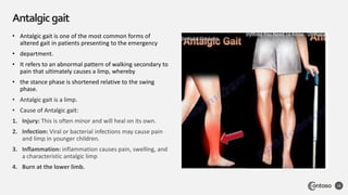 inpatient acute burn stage (excersising in the first stage ...