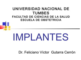 IMPLANTES
Dr. Feliciano Víctor Gutarra Cerrón
UNIVERSIDAD NACIONAL DE
TUMBES
FACULTAD DE CIENCIAS DE LA SALUD
ESCUELA DE OBSTETRICIA
 
