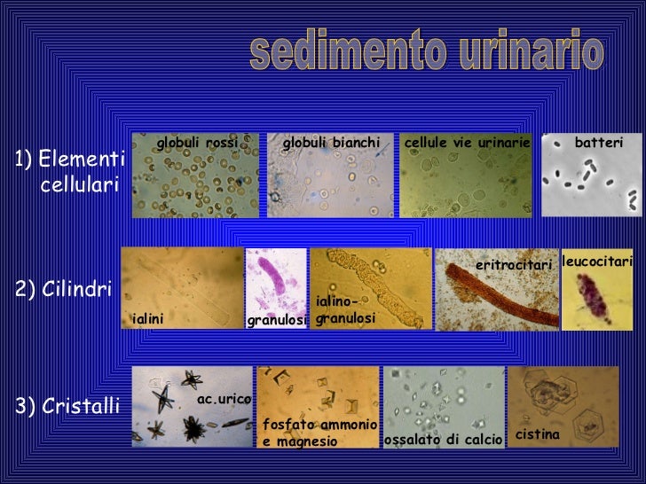 Inquadramento ematuria Inquadramento ematuria
