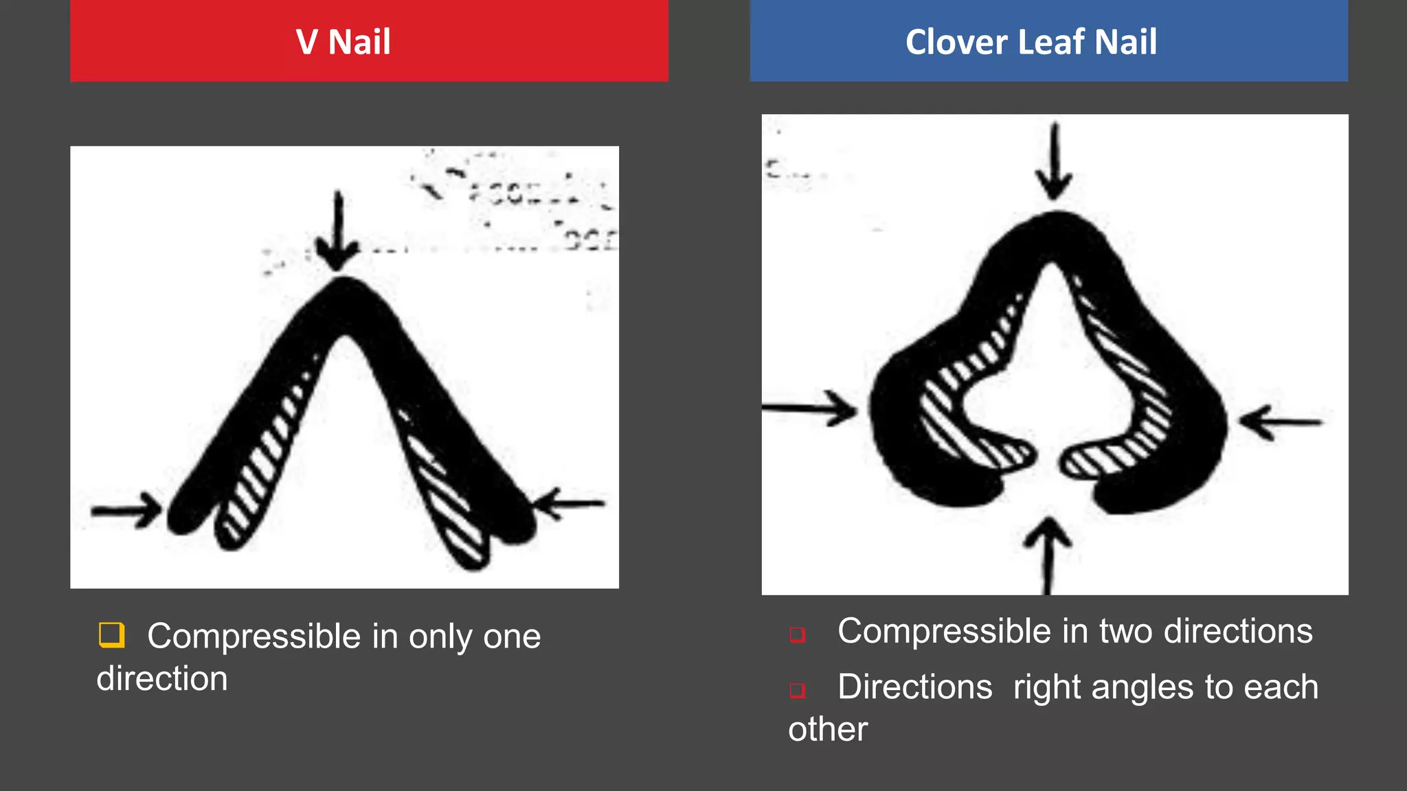  Compressible in two directions
 Directions right angles to each
other
V Nail Clover Leaf Nail
 Compressible in only one
direction
 