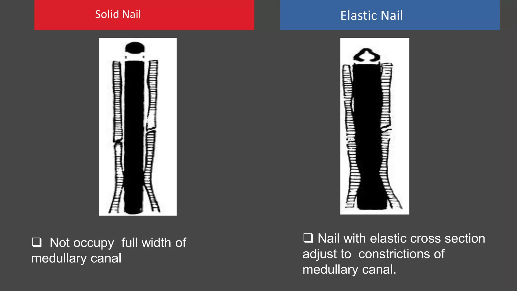 Solid Nail Elastic Nail
 Not occupy full width of
medullary canal
 Nail with elastic cross section
adjust to constrictions of
medullary canal.
 