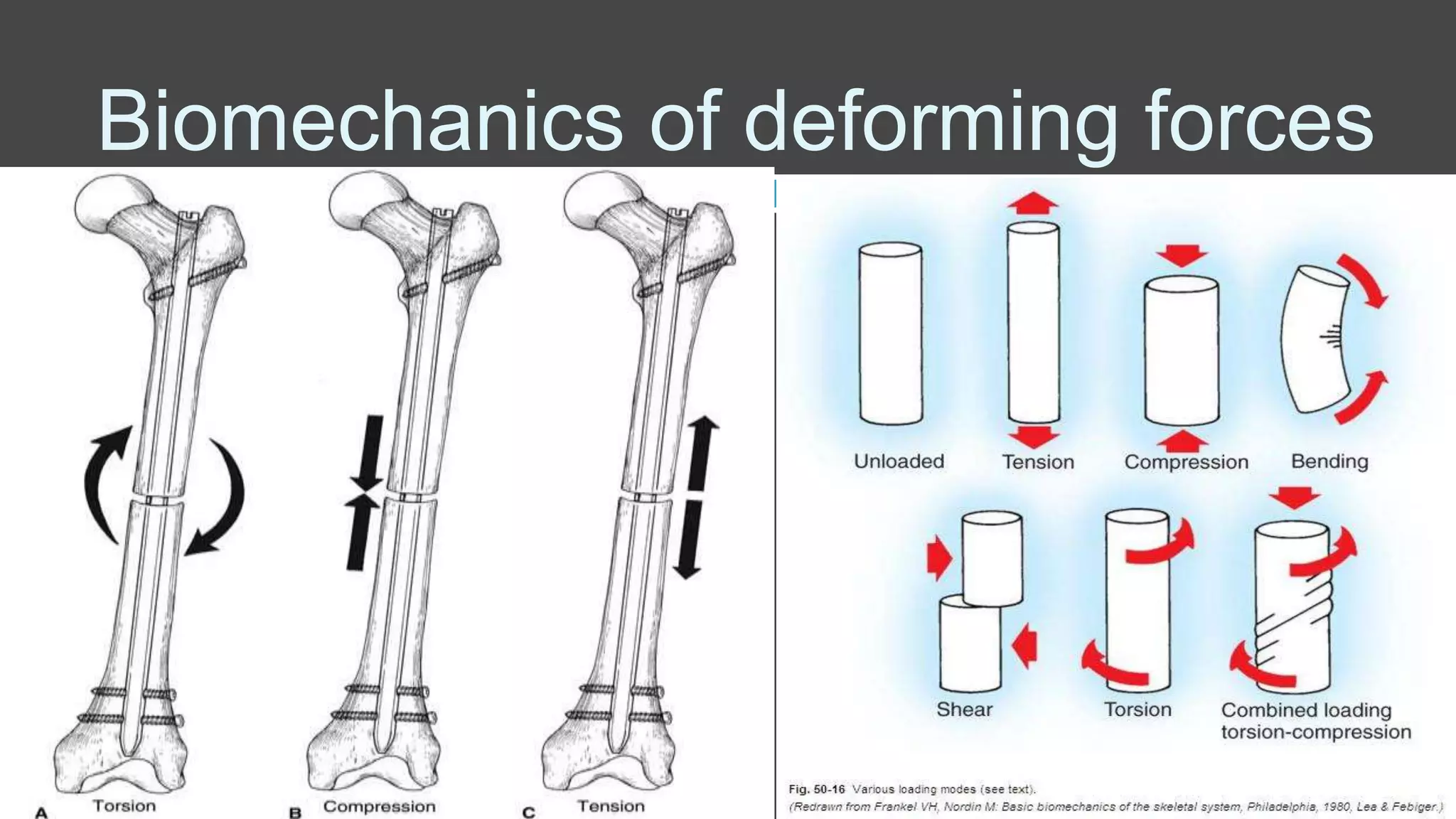 Biomechanics of deforming forces
 