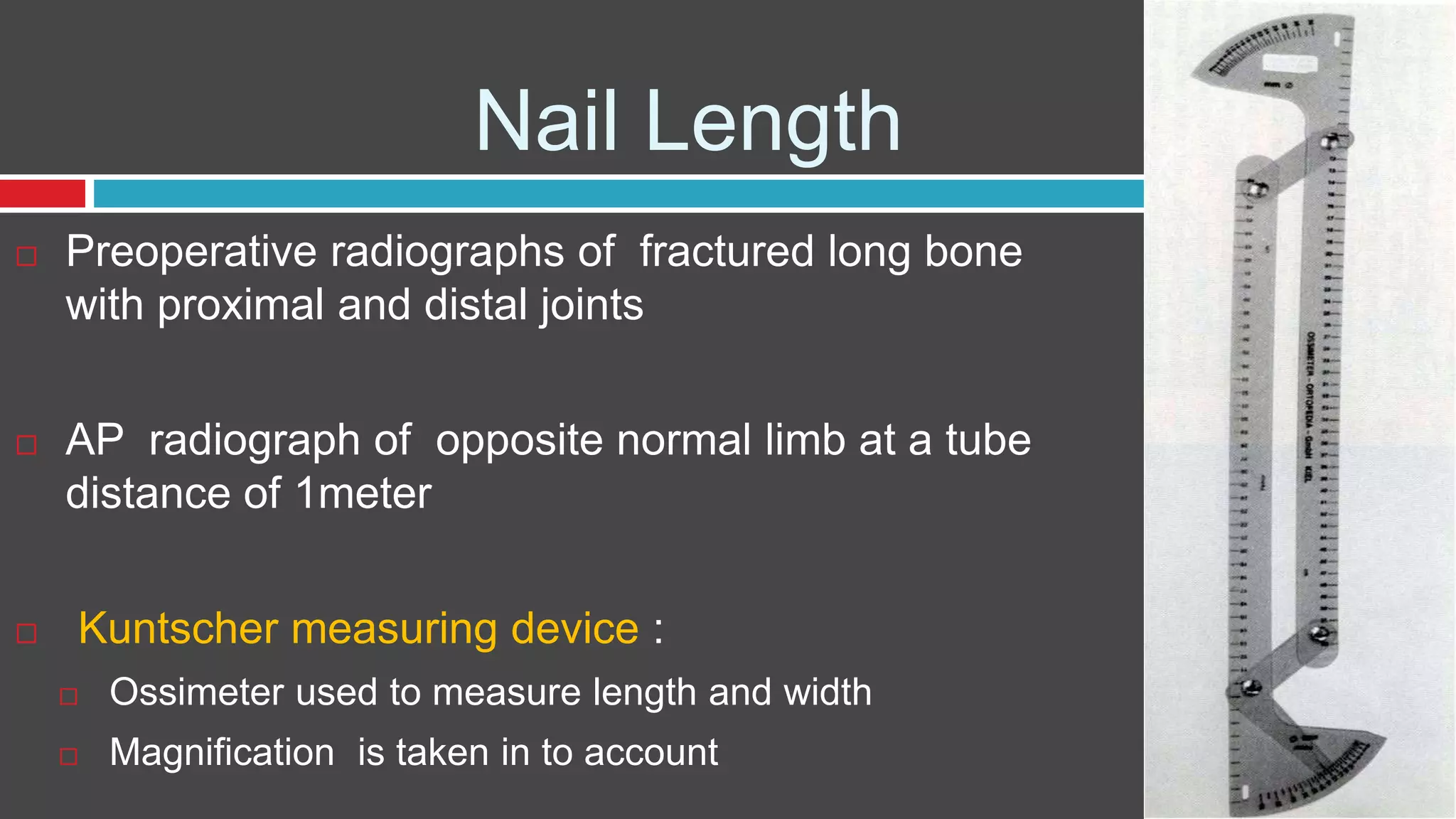 Nail Length
 Preoperative radiographs of fractured long bone
with proximal and distal joints
 AP radiograph of opposite normal limb at a tube
distance of 1meter
 Kuntscher measuring device :
 Ossimeter used to measure length and width
 Magnification is taken in to account
 