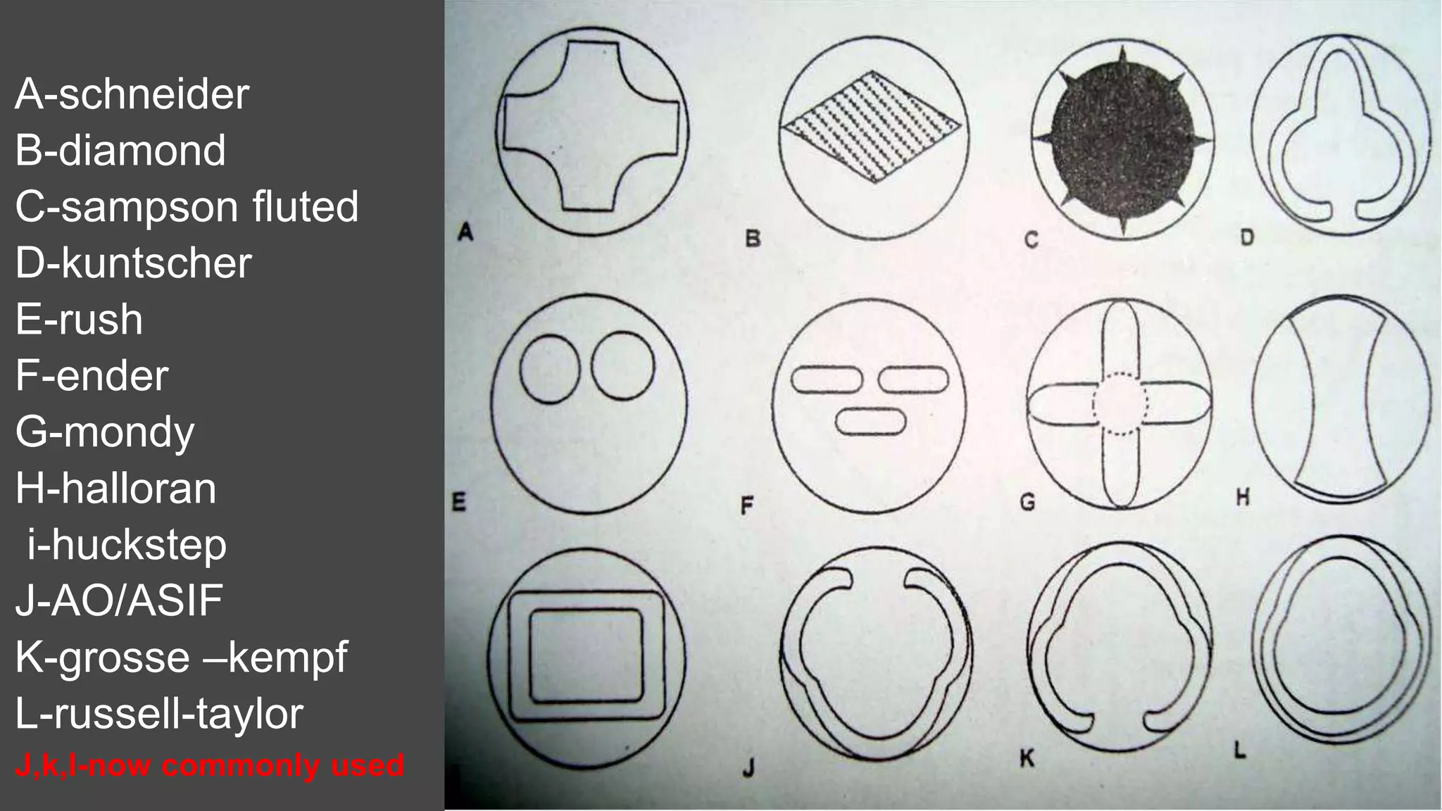 A-schneider
B-diamond
C-sampson fluted
D-kuntscher
E-rush
F-ender
G-mondy
H-halloran
i-huckstep
J-AO/ASIF
K-grosse –kempf
L-russell-taylor
J,k,l-now commonly used
 