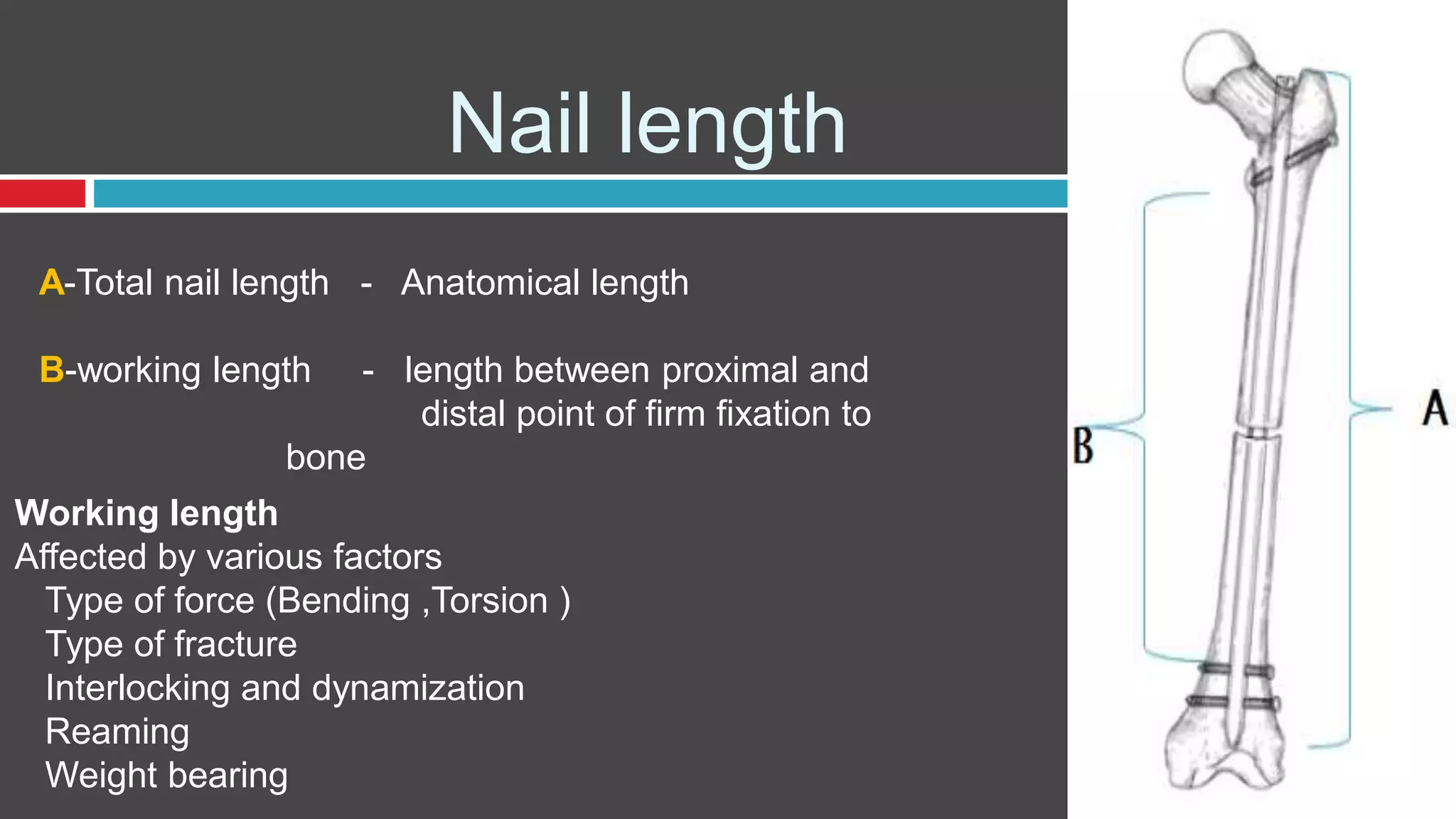 Nail length
A-Total nail length - Anatomical length
B-working length - length between proximal and
distal point of firm fixation to
bone
Working length
Affected by various factors
Type of force (Bending ,Torsion )
Type of fracture
Interlocking and dynamization
Reaming
Weight bearing
 