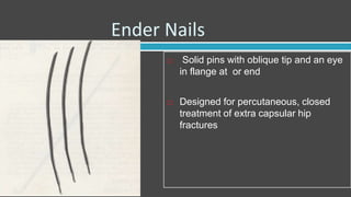 Ender Nails
 Solid pins with oblique tip and an eye
in flange at or end
 Designed for percutaneous, closed
treatment of extra capsular hip
fractures
 