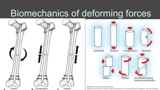 Biomechanics of deforming forces
 