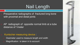 Nail Length
 Preoperative radiographs of fractured long bone
with proximal and distal joints
 AP radiograph of opposite normal limb at a tube
distance of 1meter
 Kuntscher measuring device :
 Ossimeter used to measure length and width
 Magnification is taken in to account
 