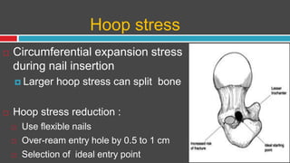 Hoop stress
 Circumferential expansion stress
during nail insertion
 Larger hoop stress can split bone
 Hoop stress reduction :
 Use flexible nails
 Over-ream entry hole by 0.5 to 1 cm
 Selection of ideal entry point
 