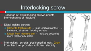 Interlocking screw
 Location of distal locking screws affects
biomechanics of fracture
 Distal locking screws
 Closer to fracture site - less cortical contact -
increased stress on locking screws
 Distal from fracture site - fracture becomes
more rotationally stable
 Interlocking screws positioned at least 2 cm
from fracture provides sufficient stability
 