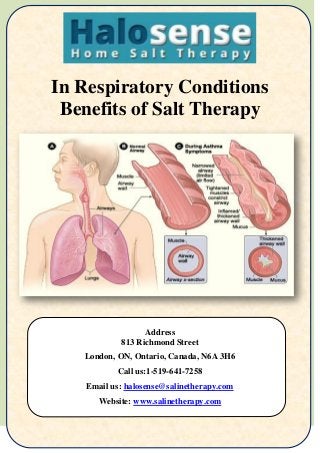 In Respiratory Conditions
Benefits of Salt Therapy
Address
813 Richmond Street
London, ON, Ontario, Canada, N6A 3H6
Call us:1-519-641-7258
Email us: halosense@salinetherapy.com
Website: www.salinetherapy.com
 