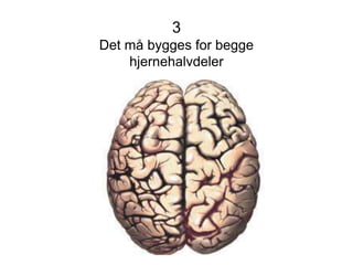 3
Det må bygges for begge
hjernehalvdeler
 