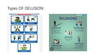 Types OF DELUSION:
 