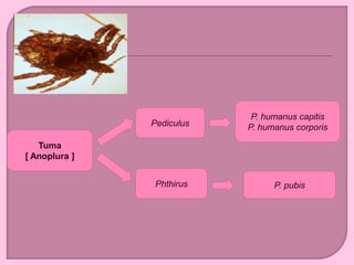 Tuma
[ Anoplura ]
P. humanus capitis
P. humanus corporis
Phthirus
Pediculus
P. pubis
 