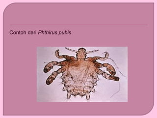Contoh dari Phthirus pubis
 
