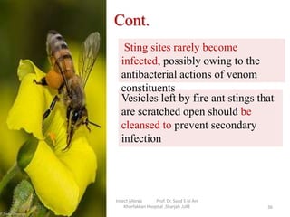 Cont.
Sting sites rarely become
infected, possibly owing to the
antibacterial actions of venom
constituents
Vesicles left ...
