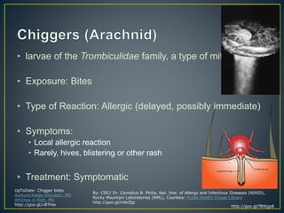 Philip Rash Arthropod Allergy | PPTX