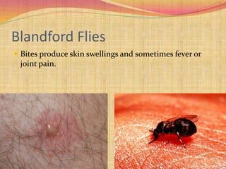 Blandford Flies
 Bites produce skin swellings and sometimes fever or
joint pain.
 