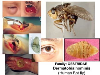 Family: OESTRIDAE
Dermatobia hominis
  (Human Bot fly)
 