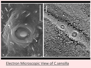 Electron Microscopic View of C.sensilla
 