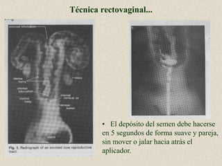 Técnica rectovaginal...
• El depósito del semen debe hacerse
en 5 segundos de forma suave y pareja,
sin mover o jalar hacia atrás el
aplicador.
 