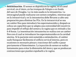  Inseminación. El semen se deposita en la vagina, en el canal
  cervical, en el útero, en las trompas de Falopio o en fondo
  del saco de Douglas. La vía más usada es la intrauterina. La
  intravaginal puede realizarse con semen completo, mientras que
  en la intracervical y en la intrauterina debe llevarse a cabo una
  preparación para eliminar las PGs. En la intracervical se usa
  un catéter fino para introducir los espermatozoides y después se
  coloca un capuchón que se adapta una convexidad del exocérvix
  para impedir el reflujo del semen a la vagina que es retirado a las
  6-8 horas. La inseminación intrauterina se realiza con un catéter
  fino con el cual se introducen los espermatozoides en la cavidad
  uterina. Si la paciente está sometida a estimulación, el catéter
  suele franquear fácilmente el orificio cervical interno, pero en
  ocasiones es necesario pinzar y traccionar del cuello o pasar
  previamente el histerómetro. La inyección de semen se realiza
  lentamente para evitar la distensión del útero y que se produzcan
  contracciones que puedan expulsarlo a la vagina.
 