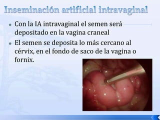  Con la IA intravaginal el semen será
depositado en la vagina craneal
 El semen se deposita lo más cercano al
cérvix, en el fondo de saco de la vagina o
fornix.
 