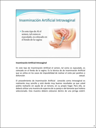 Inseminación Artificial Intravaginal

En este tipo de Inseminación Artificial el semen, tal como es eyaculado, es
colocado en el fondo de la vagina. Es la técnica de de Inseminación Artificial
que se utiliza en los casos de imposibilidad de realizar el coito por parálisis o
disfunción                                                               sexual.

El procedimiento de Inseminación Artificial conocido como Intravaginal es
realmente muy sencillo y está dando muy buenos resultados ya que usted
podría realizarlo sin ayuda de un tercero, en su propio hogar. Para ello, se
deberá utilizar una muestra de esperma de su pareja o del donante que hubiera
seleccionado. Esta muestra deberá colocarse dentro de una jeringa estéril.




                                                                                    7
 