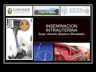 INSEMINACION
INTRAUTERINA
Jorge Antonio Huatuco Hernández
 