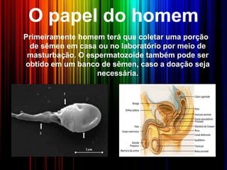 O papel do homem
Primeiramente homem terá que coletar uma porção
de sêmen em casa ou no laboratório por meio de
masturbação. O espermatozoide também pode ser
obtido em um banco de sêmen, caso a doação seja
necessária.
 