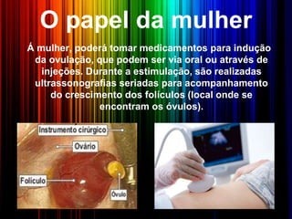 O papel da mulher
Á mulher, poderá tomar medicamentos para indução
da ovulação, que podem ser via oral ou através de
injeções. Durante a estimulação, são realizadas
ultrassonografias seriadas para acompanhamento
do crescimento dos folículos (local onde se
encontram os óvulos).
 