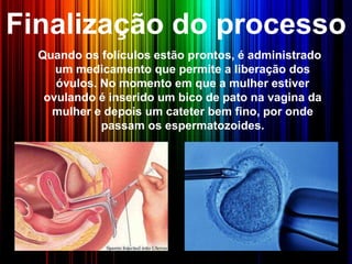 Finalização do processo
Quando os folículos estão prontos, é administrado
um medicamento que permite a liberação dos
óvulos. No momento em que a mulher estiver
ovulando é inserido um bico de pato na vagina da
mulher e depois um cateter bem fino, por onde
passam os espermatozoides.
 