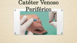 Catéter Venoso
Periférico
 