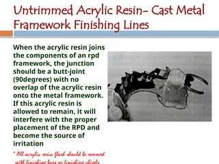 Metal Rpd Finish Line insertion-and-postinsertion-of-rpd-240427004558-82e51de2.pptx
