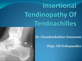 Dr. Chandrashekhar Sonawane

      -Dept. Of Orthopaedics
 