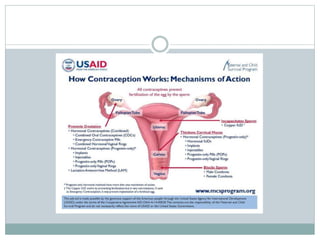 insertion of IUD devices.pptx