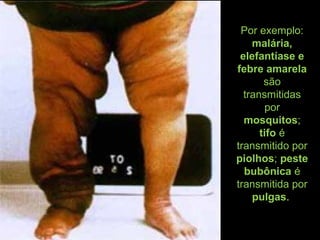 Por exemplo:
malária,
elefantíase e
febre amarela
são
transmitidas
por
mosquitos;
tifo é
transmitido por
piolhos; peste
bubônica é
transmitida por
pulgas.
 