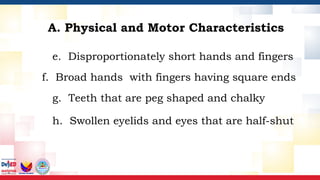 e. Disproportionately short hands and fingers
f. Broad hands with fingers having square ends
g. Teeth that are peg shaped and chalky
h. Swollen eyelids and eyes that are half-shut
A. Physical and Motor Characteristics
 