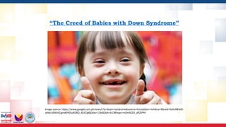 “The Creed of Babies with Down Syndrome”
Image source: https://www.google.com.ph/search?q=down+syndrome&source=lnms&tbm=isch&sa=X&ved=0ahUKEwi0-
aHtq-XXAhVGgrwKHXSuAO8Q_AUICigB&biw=1366&bih=613#imgrc=nOmSGOI_afGEPM:
 