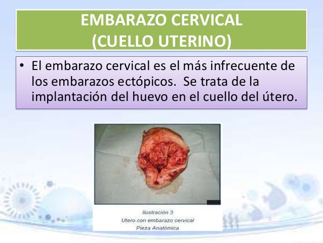 Mensual la semana antes el dolor en los riñones