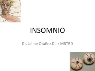 INSOMNIO
Dr. Jaime Otañez Diaz MRTRD
 