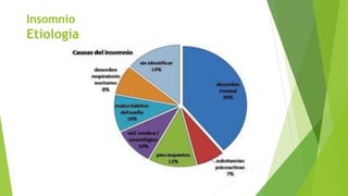Insomnio
Etiología
 