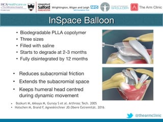 @thearmclinic
InSpace Balloon
• Biodegradable PLLA copolymer

• Three sizes

• Filled with saline

• Starts to degrade at 2-3 months

• Fully disintegrated by 12 months
• Bozkurt M, Akkaya M, Gursoy S et al. Arthrosc Tech. 2005
• Holschen M, Brand F, Agneskirchner JD.Obere Extremität. 2016
• Reduces subacromial friction

• Extends the subacromial space

• Keeps humeral head centred
during dynamic movement
 