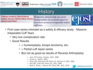 @thearmclinic
History
• First case series intended as a safety & efficacy study - Massive
Irreparable Cuff Tears

• Very low complication rate

• Good Results 

• = humeroplasty, biceps tenotomy, etc.

• = Partial cuff repair series

• But not as good as results of Reverse Arthroplasty
• Jost, Pfirrmann, Gerber. JBJS. 2000
• Green A. JAAOS. 2003
• Dines DM, Moynihan DP, Dines JS, McCann P. JBJS. 2006
• Neri BR, Chan KW, Kwon YK. JSES. 2009
• Bedi A, Dines J, Warren RF, Dines DM. JBJS. 2010
 