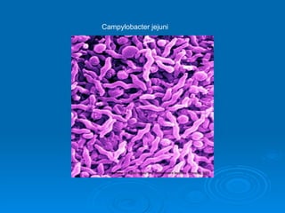 Campylobacter jejuni 