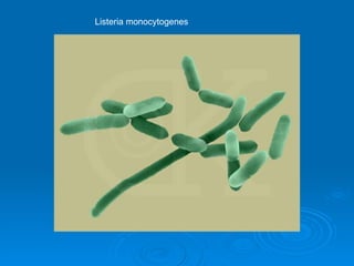 Listeria monocytogenes 