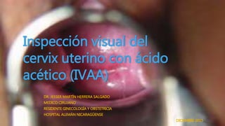 Inspección visual del
cervix uterino con ácido
acético (IVAA)
DR. JESSER MARTÍN HERRERA SALGADO
MEDICO CIRUJANO
RESIDENTE GINECOLOGÍA Y OBSTETRICIA
HOSPITAL ALEMÁN NICARAGÜENSE
DICIEMBRE 2015
 