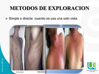 METODOS DE EXPLORACION
Simple o directa cuando se usa una solo vista.