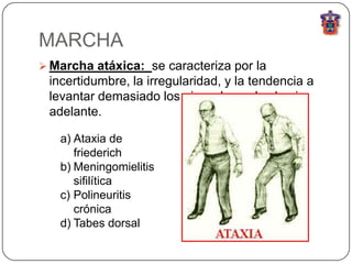 MARCHA
 Marcha atáxica: se caracteriza por la
 incertidumbre, la irregularidad, y la tendencia a
 levantar demasiado los pies y lanzarlos hacia
 adelante.

   a) Ataxia de
      friederich
   b) Meningomielitis
      sifilítica
   c) Polineuritis
      crónica
   d) Tabes dorsal
 